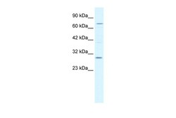 Aviva Systems Biology Corp KCNIP1 Antibody - N-terminal region (ARP35246_T100)