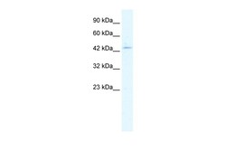 Aviva Systems Biology Corp CLIC5 Antibody - middle region (ARP35262_T100)