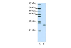 Aviva Systems Biology Corp CLIC5 Antibody - C-terminal region (ARP35263_T100)