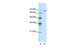 Aviva Systems Biology Corp GABRQ Antibody - N-terminal region (ARP35283_P050)