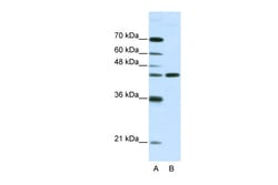 Aviva Systems Biology Corp NMUR2 Antibody - N-terminal region (ARP35300_T100)