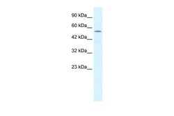 Aviva Systems Biology Corp KCNK10 Antibody - C-terminal region (ARP35326_T100)