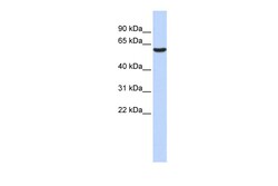 Aviva Systems Biology Corp GABRB3 Antibody - middle region (ARP35339_P050)