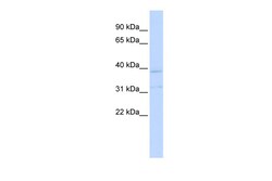 Aviva Systems Biology Corp KCNK15 Antibody - middle region (ARP35350_P050)