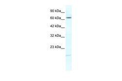 Aviva Systems Biology Corp KCNH6 Antibody - N-terminal region (ARP35363_T100)