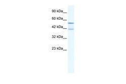 Aviva Systems Biology Corp KCNK10 Antibody - N-terminal region (ARP35399_T100)