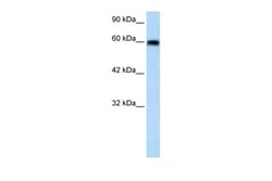 Aviva Systems Biology Corp VMD2L2 Antibody - N-terminal region (ARP35424_T100)