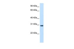 Aviva Systems Biology Corp KCTD6 Antibody - N-terminal region (ARP35425_T100)