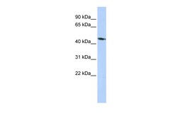 Aviva Systems Biology Corp KCNJ1 Antibody - middle region (ARP35432_P050)