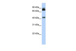 Aviva Systems Biology Corp P2RX2 Antibody - N-terminal region (ARP35434_P050)
