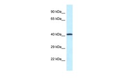 Aviva Systems Biology Corp P2rx2 Antibody - middle region (ARP35437_P050)
