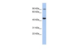 Aviva Systems Biology Corp KCNH2 Antibody - C-terminal region (ARP35450_P050)