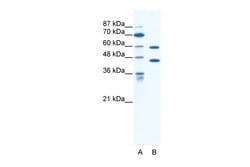 Aviva Systems Biology Corp CATSPER2 Antibody - C-terminal region (ARP35452_T100)