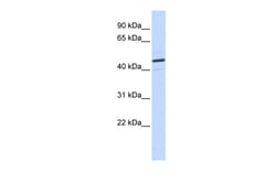 Aviva Systems Biology Corp CATSPER2 Antibody - N-terminal region (ARP35453_P050)