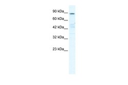 Aviva Systems Biology Corp KCNQ2 Antibody - N-terminal region (ARP35456_P050)