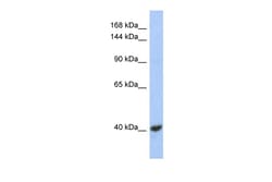Aviva Systems Biology Corp KCNQ2 Antibody - middle region (ARP35457_P050)
