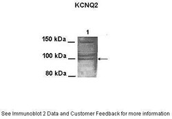 Aviva Systems Biology Corp KCNQ2 Antibody - N-terminal region (ARP35458_P050)
