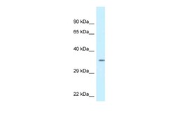 Aviva Systems Biology Corp KCNIP2 Antibody - C-terminal region (ARP35489_P050)