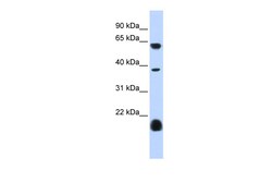 Aviva Systems Biology Corp HTR3E Antibody - middle region (ARP35532_P050)