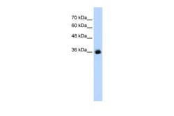 Aviva Systems Biology Corp GABRG2 Antibody - C-terminal region (ARP35574_T100)