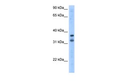 Aviva Systems Biology Corp KCNRG Antibody - N-terminal region (ARP35588_T100)