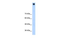 Aviva Systems Biology Corp TRPM3 Antibody - N-terminal region (ARP35609_T100)