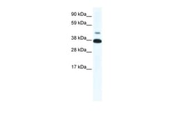 Aviva Systems Biology Corp THRB Antibody - N-terminal region (ARP35636_P050)