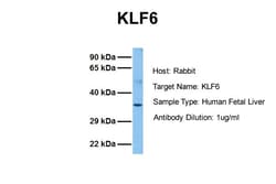Aviva Systems Biology Corp KLF6 Antibody - N-terminal region (ARP35640_P050)