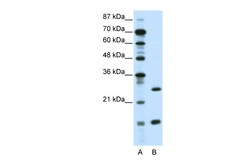 Aviva Systems Biology Corp CEBPG Antibody - N-terminal region (ARP35645_P050)