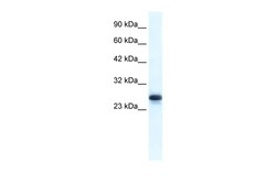 Aviva Systems Biology Corp HMGB1 Antibody - middle region (ARP35646_T100)
