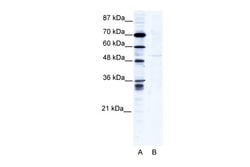 Aviva Systems Biology Corp ZNF134 Antibody - N-terminal region (ARP35676_T100)