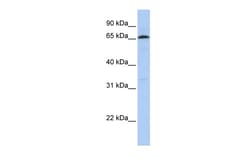 Aviva Systems Biology Corp ZNF136 Antibody - N-terminal region (ARP35679_P050)