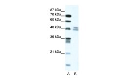 Aviva Systems Biology Corp TRIP13 Antibody - N-terminal region (ARP35724_T100)