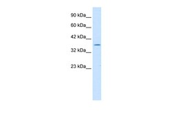 Aviva Systems Biology Corp ILF2 Antibody - C-terminal region (ARP35731_T100)