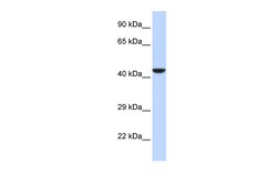 Aviva Systems Biology Corp NMI Antibody - middle region (ARP35737_P050)