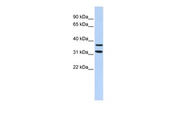 Aviva Systems Biology Corp ZNF254 Antibody - middle region (ARP35753_P050)