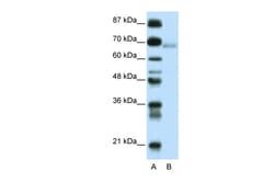 Aviva Systems Biology Corp ZBTB22 Antibody - C-terminal region (ARP35777_P050)