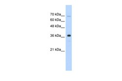 Aviva Systems Biology Corp ZRANB2 Antibody - middle region (ARP35779_P050)