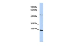 Aviva Systems Biology Corp SSX4 Antibody - middle region (ARP35783_P050)