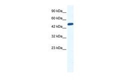 Aviva Systems Biology Corp ZNF239 Antibody - N-terminal region (ARP35784_P050)