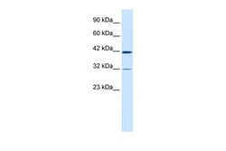 Aviva Systems Biology Corp CHST4 Antibody - middle region (ARP35786_P050)