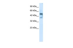 Aviva Systems Biology Corp CHST4 Antibody - middle region (ARP35787_T100)