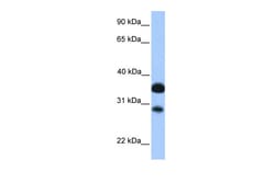 Aviva Systems Biology Corp CITED2 Antibody - N-terminal region (ARP35789_P050)