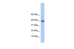Aviva Systems Biology Corp POLR2I Antibody - N-terminal region (ARP35790_P050)