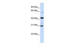 Aviva Systems Biology Corp ZNF193 Antibody - middle region (ARP35793_P050)