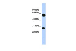 Aviva Systems Biology Corp TRIM16 Antibody - N-terminal region (ARP35801_P050)