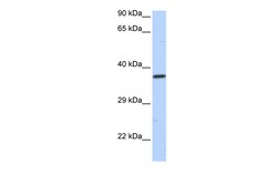 Aviva Systems Biology Corp SCML1 Antibody - N-terminal region (ARP35812_P050)