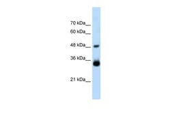 Aviva Systems Biology Corp HOXC9 Antibody - middle region (ARP35813_T100)