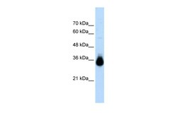 Aviva Systems Biology Corp HOXC9 Antibody - N-terminal region (ARP35814_T100)