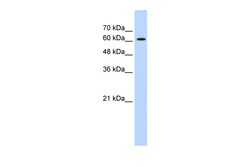 Aviva Systems Biology Corp ZIC2 Antibody - C-terminal region (ARP35821_P050)